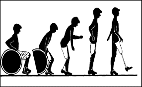 Ampute Rehabilitasyonu