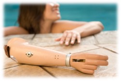 Üst Ekstremite Kol Protezleri - Biyonik eller- Myoelektrik Eller - Mekanik Protezler 