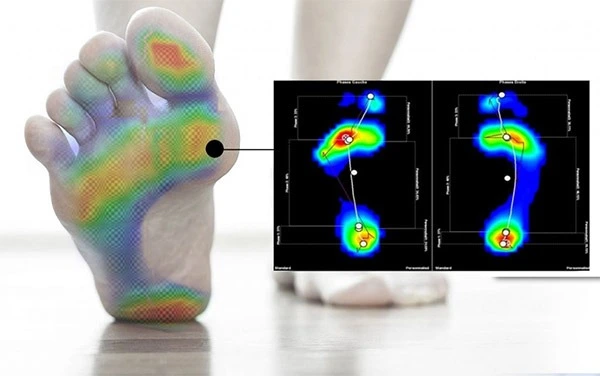 Kişiye Özel Tabanlık