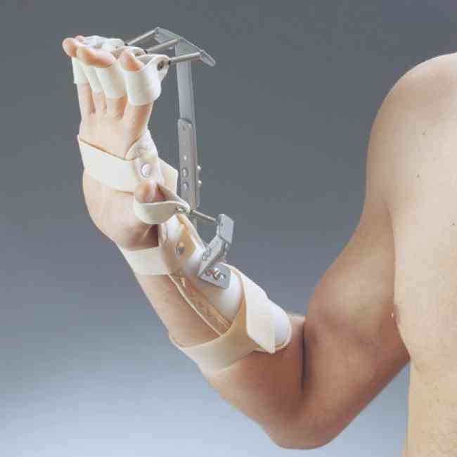 Dinamik El Bilek Parmak Splinti (Ölçü ve Provalı)