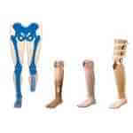 Diz Altı Protezleri