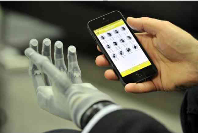 I- Limp Ultra Bionik El Protezi