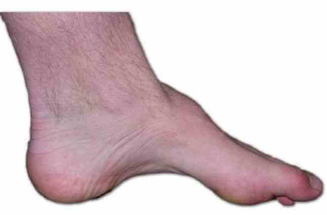 Yüksek Kavis (Pescavus)