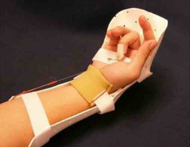 Üst Ekstremite Ortezler