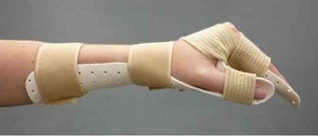Statik El Bilek İstirahat Splinti
